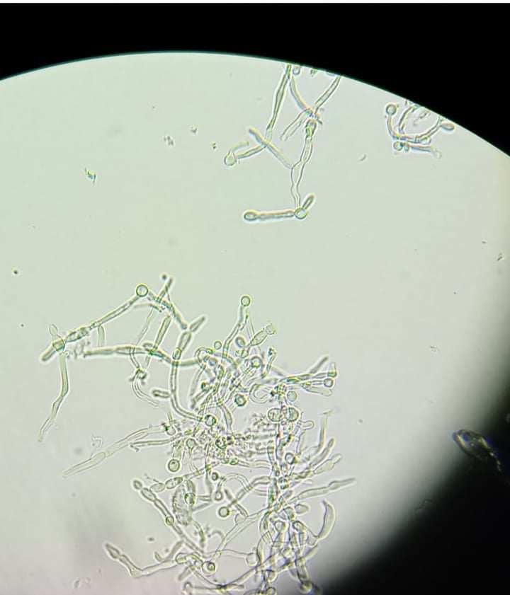 champignon pathogène